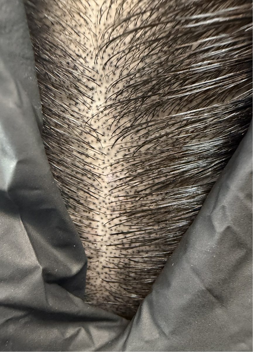 DOT. のヘアルプデザインによる仕上がり例