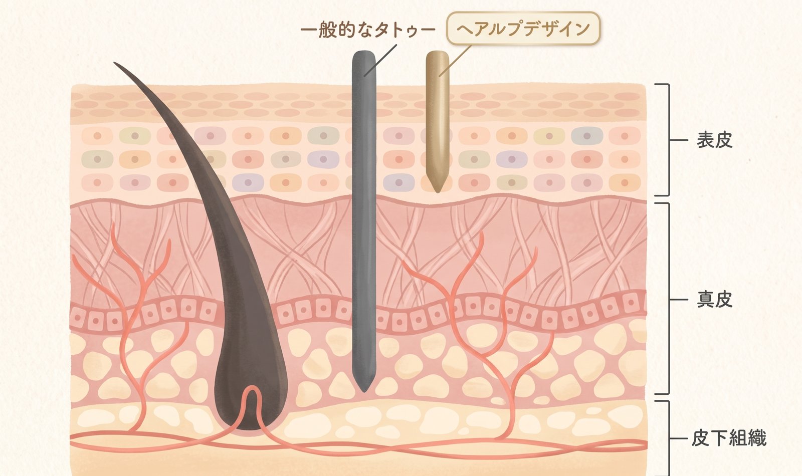 一般的なタトゥーとヘアルプデザインの、針が届く深さの違いを示した断面図